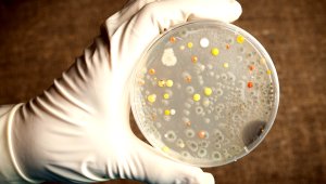 15 человек заразились сибирской язвой в Акмолинской области